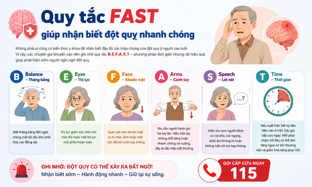 Quy tắc BEFAST nhận biết triệu chứng đột quỵ ở người cao tuổi